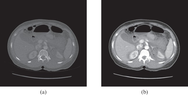 Figure 17