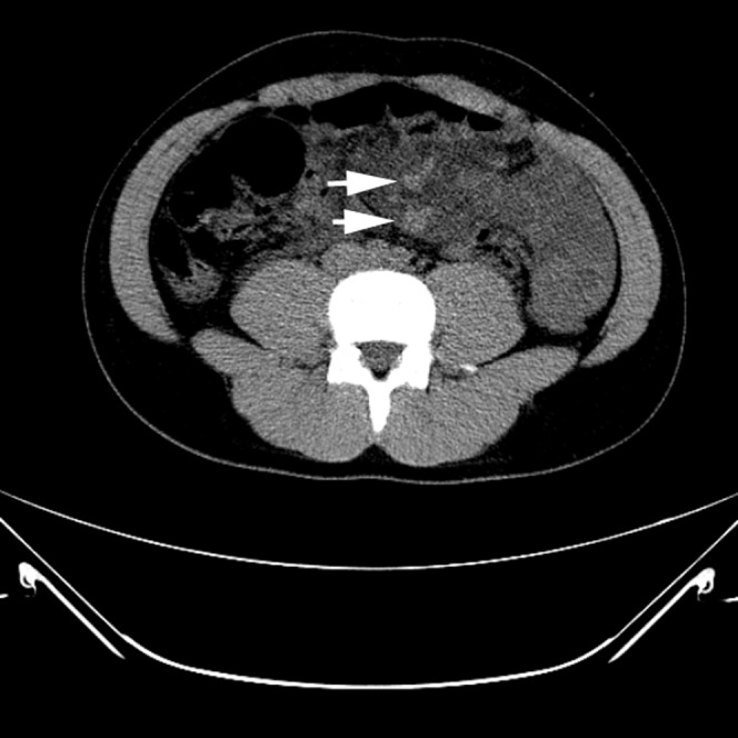 Figure 18