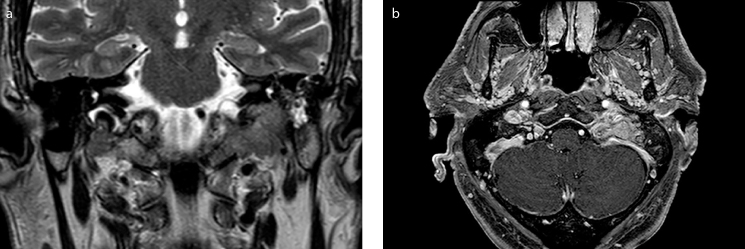 Figure 2. a, b