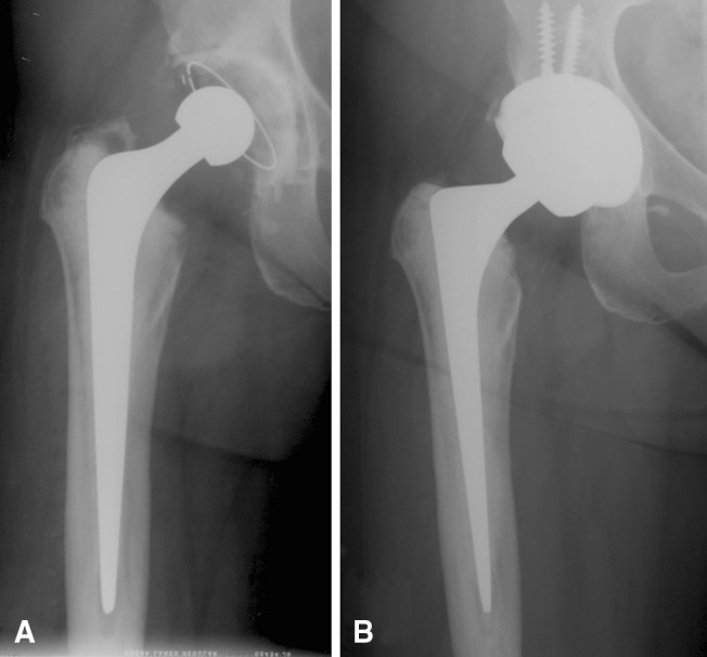 Fig. 3A–B