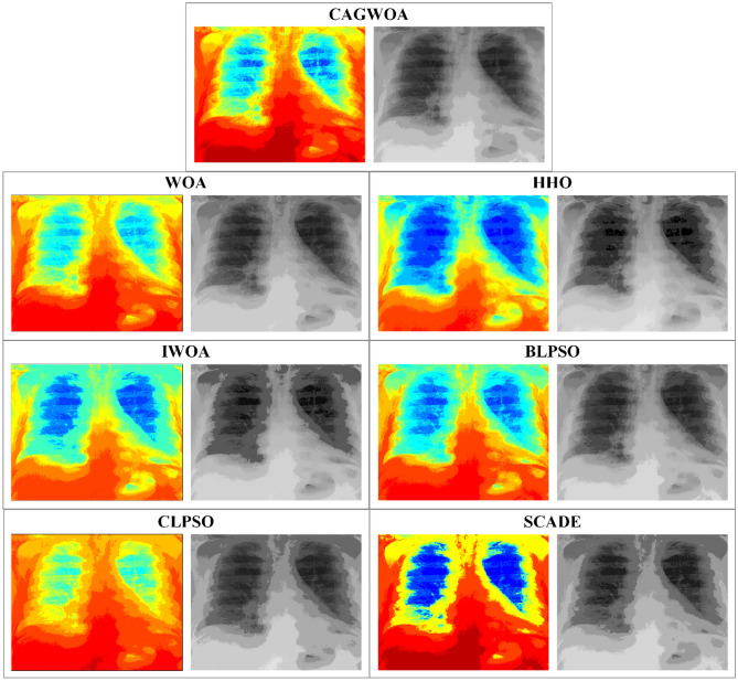 Figure 14