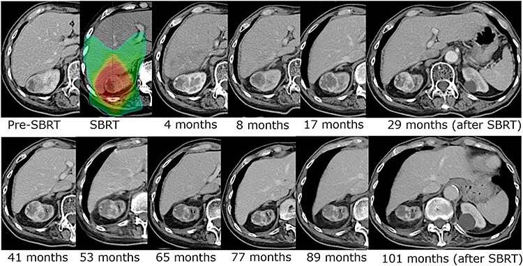 Fig. 4.