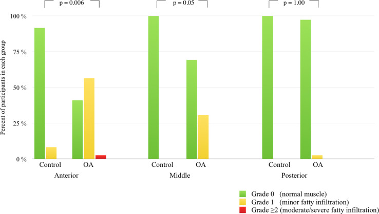 Gluteal atrophy and fatty infiltration in end-stage osteoarthritis of ...