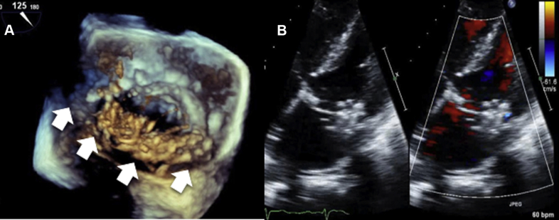 Figure 3