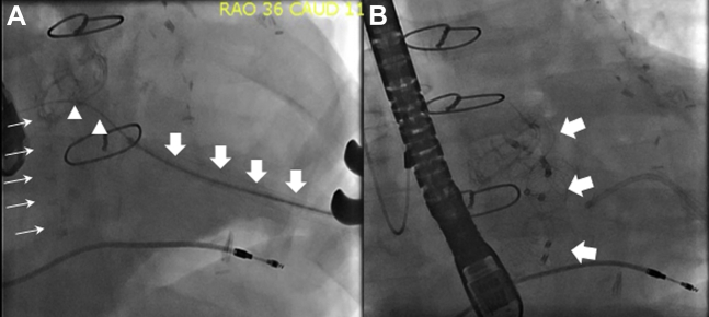 Figure 2