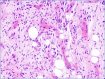 Figure 1A.