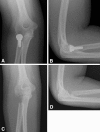 Fig. 2A–D