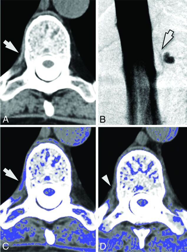 Fig 3.