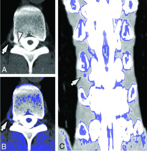 Fig 2.