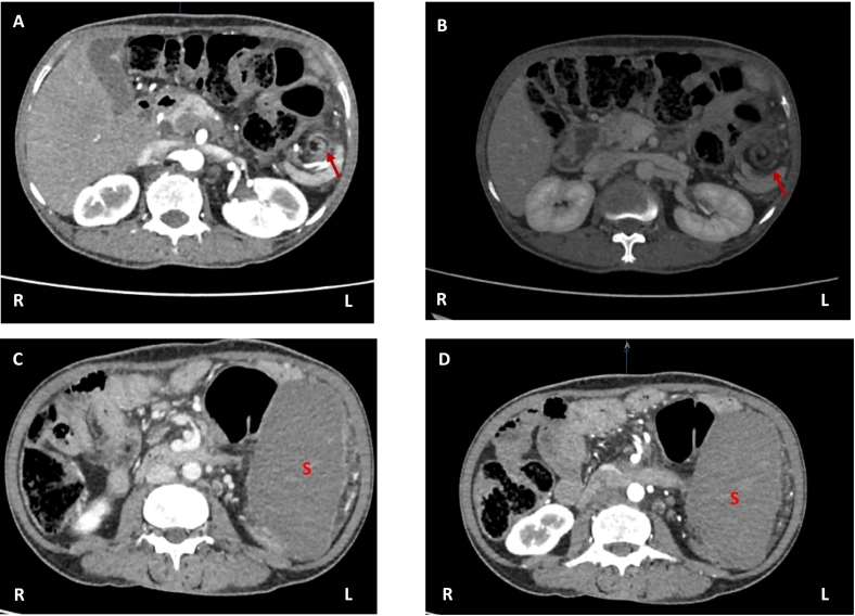 Fig. 4