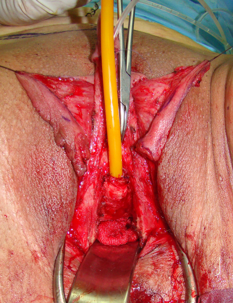 Figure 5