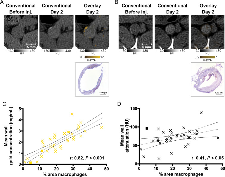 A, B, Photon-counting CT (PCCT) images of atherosclerotic macrophage burden before injection (inj.) of gold nanoparticles and 2 days after injection and corresponding photomicrographs obtained with immunostaining. A, Images of noncalcified plaque show matches of spotty areas of enhancement next to mesenteric artery branch. This section is represented by yellow dot in C and black dot in D. B, Images of calcified plaque show low enhancement on gold k-edge image, which is confirmed by low concentration of immunostained macrophages. This section is represented by yellow square in C and black square in D. C, D, Graphs show correlation between area immunostained for macrophages and, C, concentration of gold or, D, attenuation on conventional images. Dotted and dashed lines represent the linear regression line and 95% CI.
