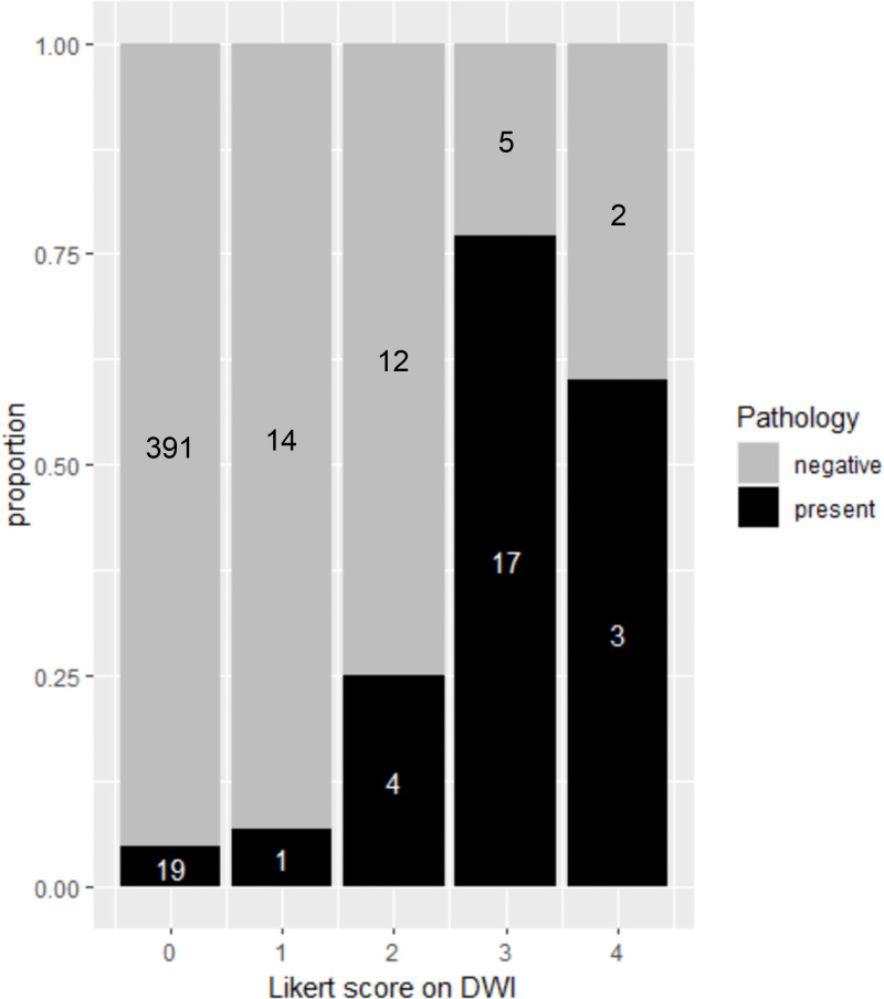 Stacked bar plot shows the per-quadrant distribution of extramural venous invasion and tumor deposit as assessed with the diffusion-weighted imaging (DWI) five-point Likert scale and whole-mount pathology. Gray area of the stacked bar represents quadrants with nonviable cells at pathology, and the black area of the stacked bars represents quadrants with viable cells at pathology. A total of 410 quadrants were assigned a Likert score of 0 (unlikely viable), 15 quadrants were assigned a Likert score of 1 (less likely viable), 16 quadrants were assigned a Likert score of 2 (possibly viable), 22 quadrants were assigned a Likert score of 3 (suspicious viable), and five quadrants were assigned a Likert score of 4 (consistent with viable).