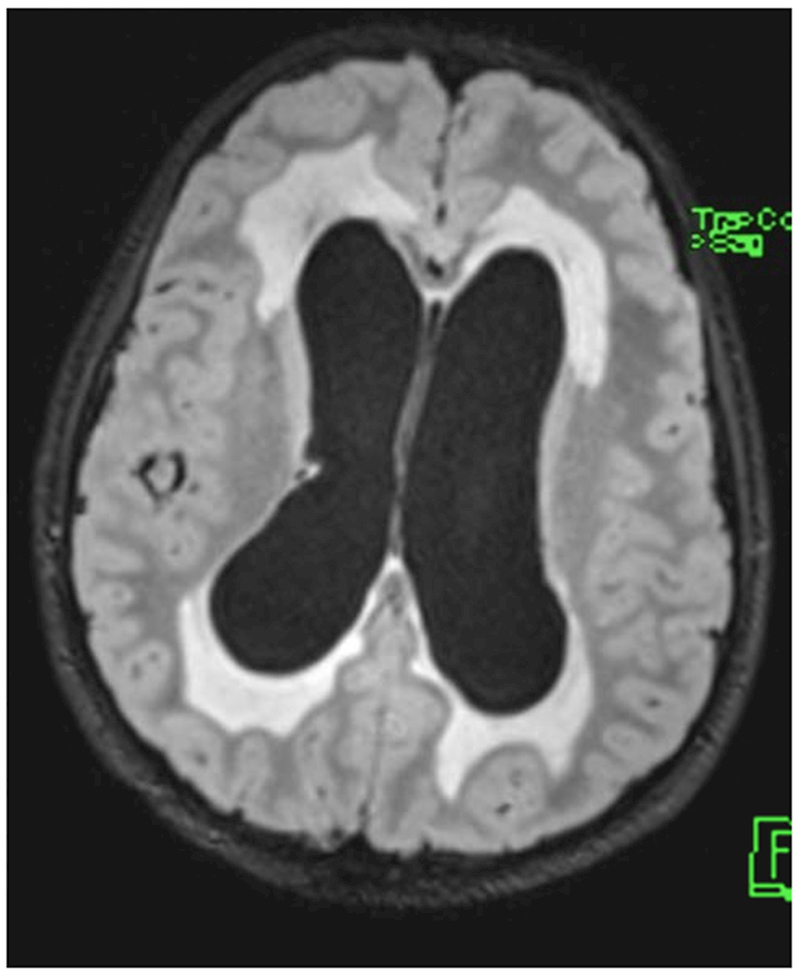 Figure 2: