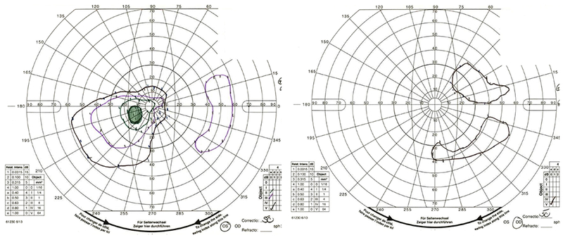 Figure 2: