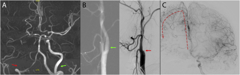 Fig. 2