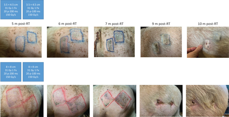 Figure 4. From left to right, pictures show the macroscopic evolution of skin lesions at various time post-FLASH treatment when 3.5 × 4.5–cm (shoulder) and 8 × 8–cm (leg) fields were irradiated. Blue schemes present a summary of the physical parameters used to irradiate the two adjacent areas. RT, radiotherapy; m, months.