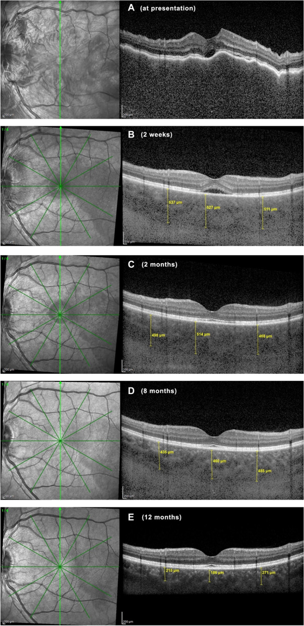 Fig. 7