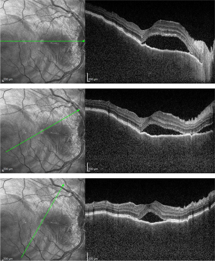 Fig. 6