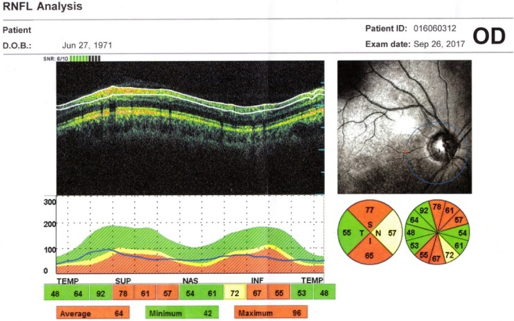 Fig. 6