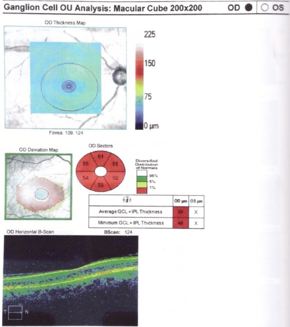 Fig. 11