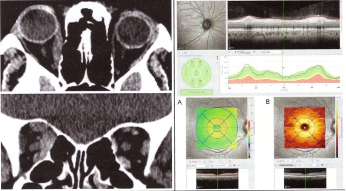 Fig. 8