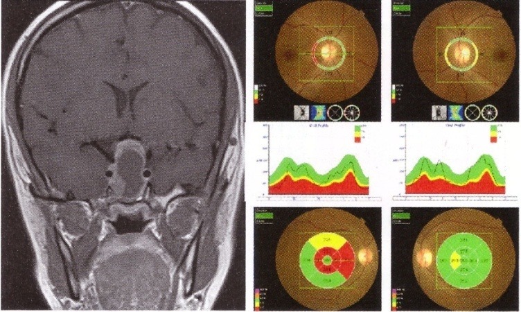 Fig. 9