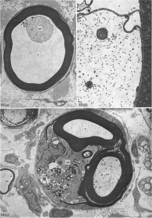 Fig. 10