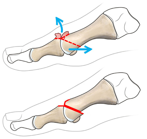 Figure 4.