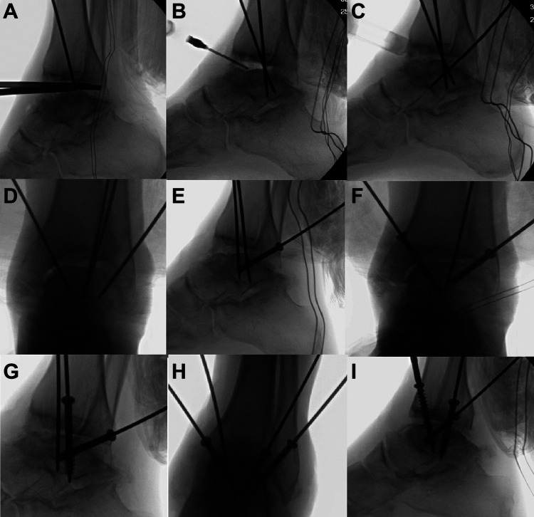 Figure 11.