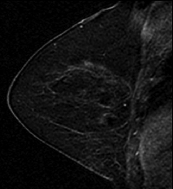 Figure 1b: