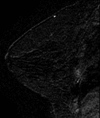 Figure 1a: