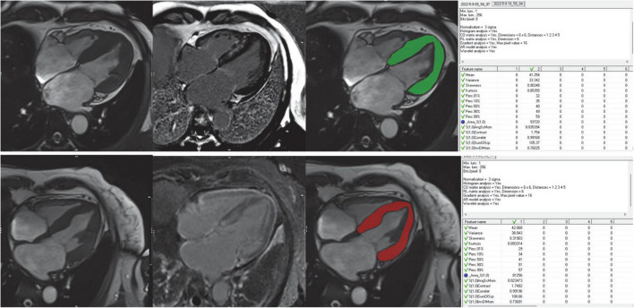 FIGURE 2