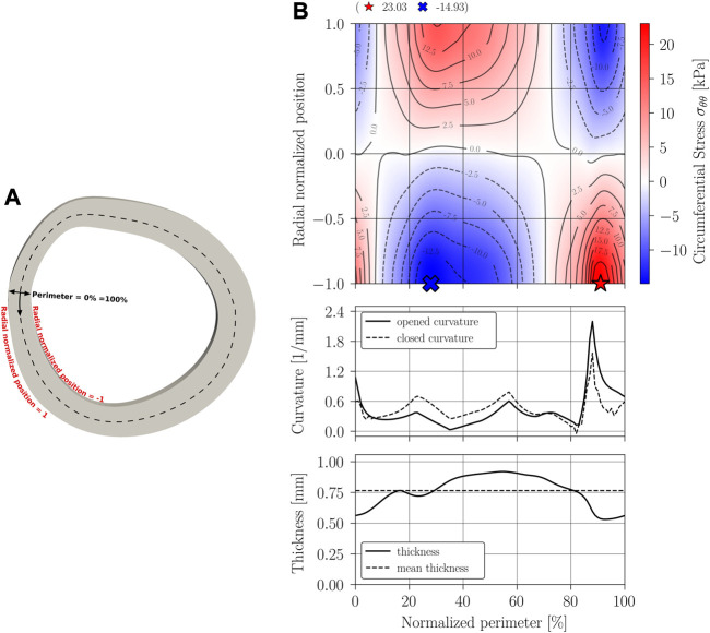 FIGURE 11