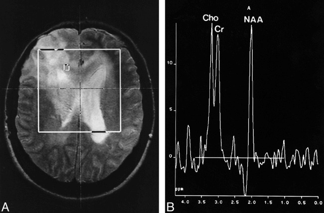 fig 1.