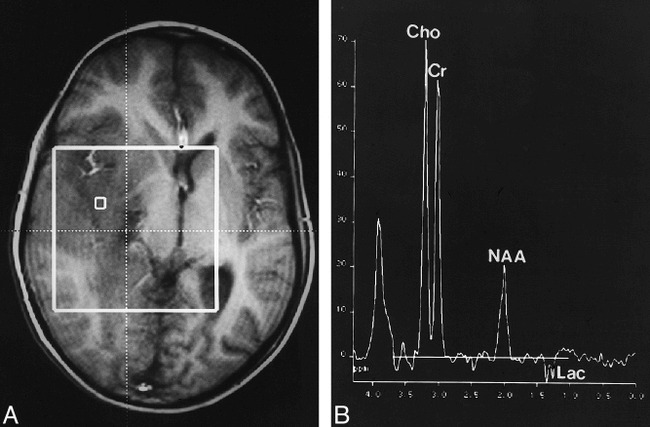 fig 2.