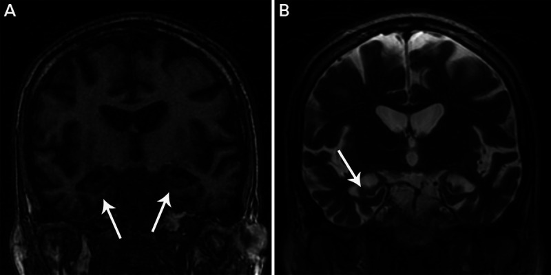 FIGURE 10-1