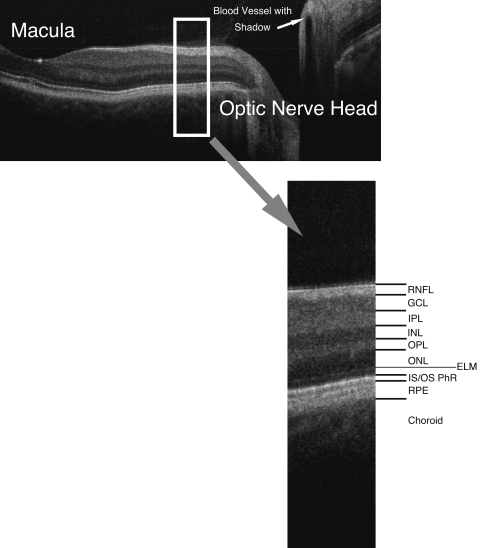 FIGURE 3