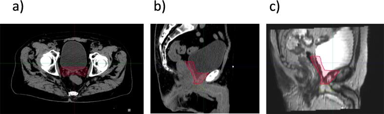 Fig. 6