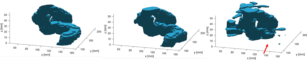 Fig. 11.