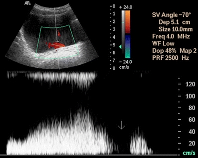 Fig. 2