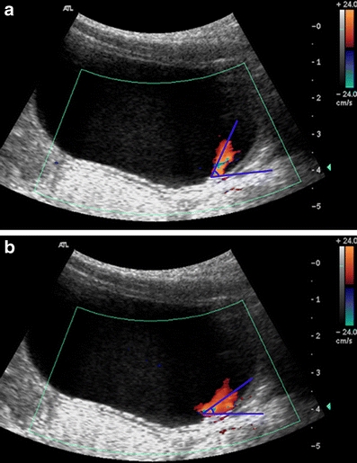 Fig. 4