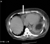FIG. 1.