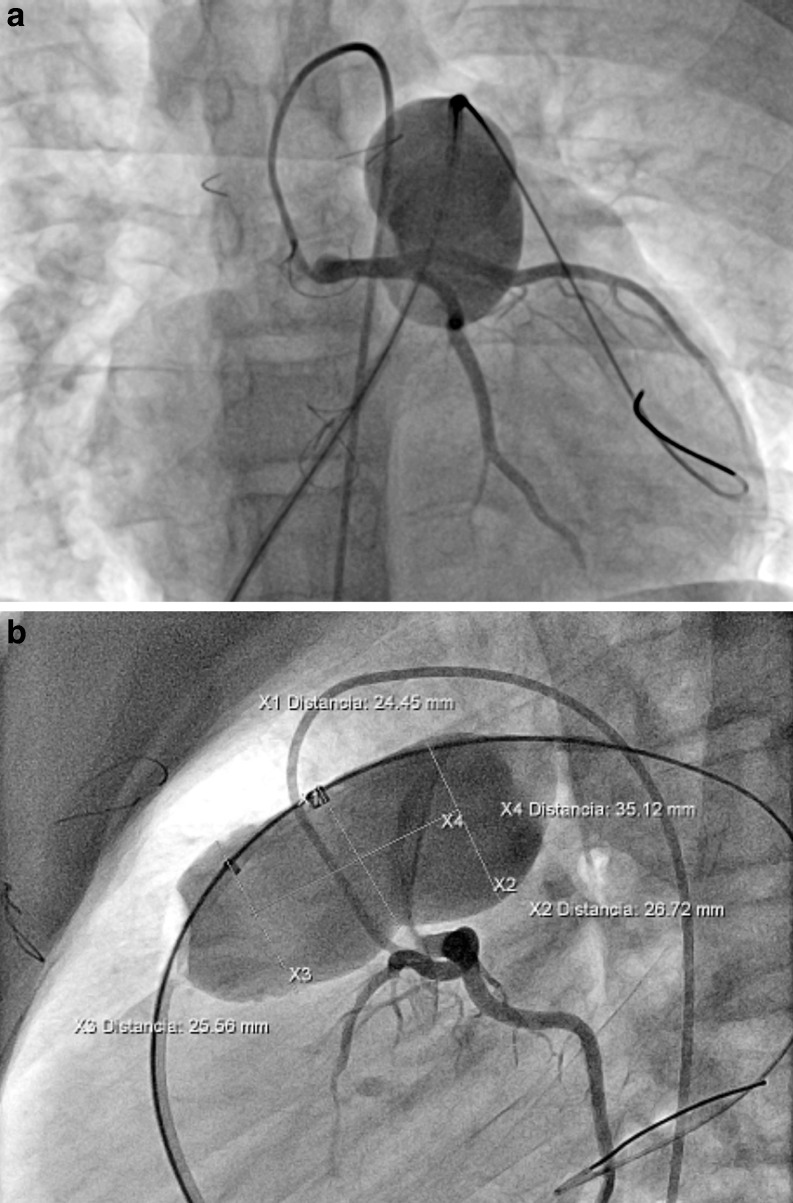 Fig. 3