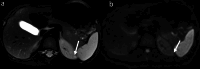 Fig. 5