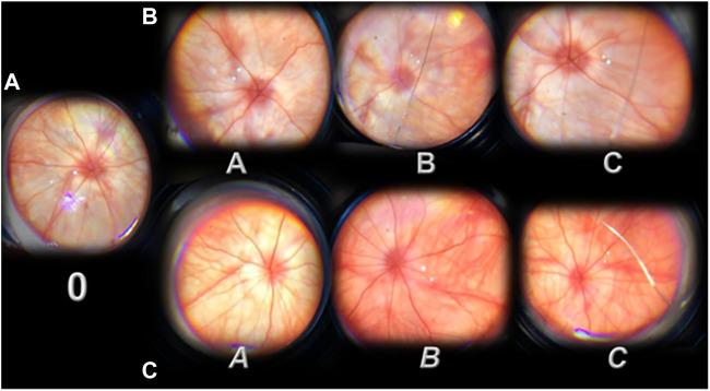 FIGURE 3