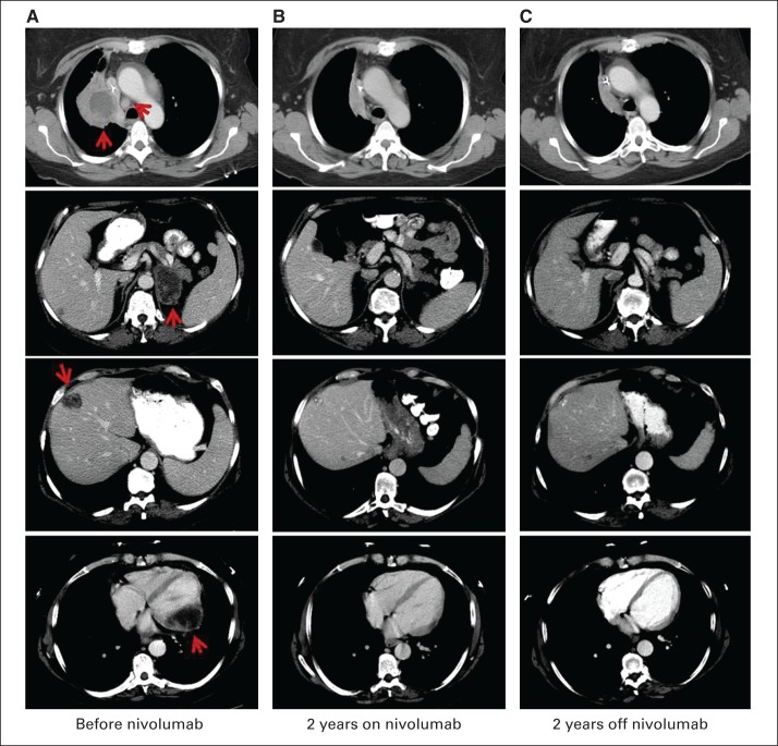 Fig 2.