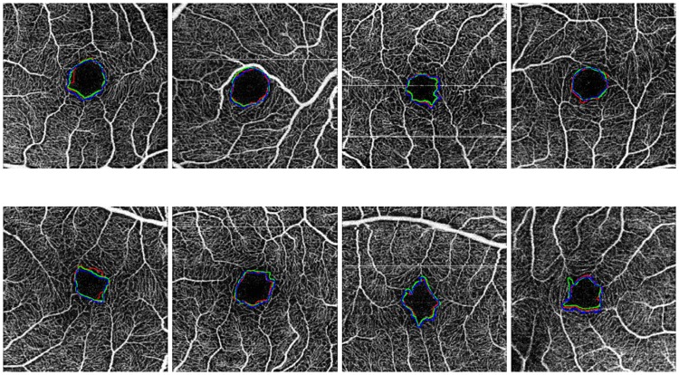 Fig 13