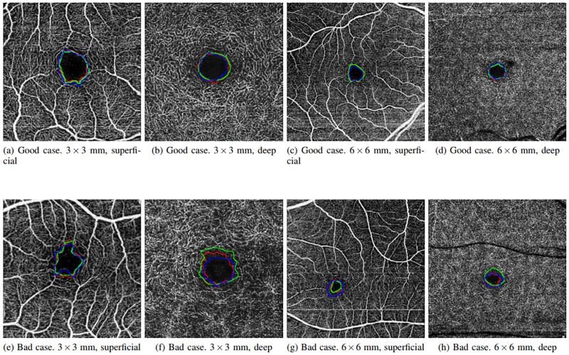 Fig 11