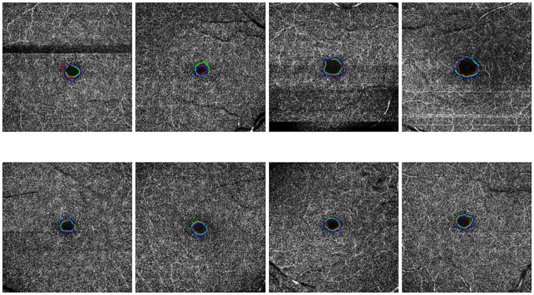 Fig 14